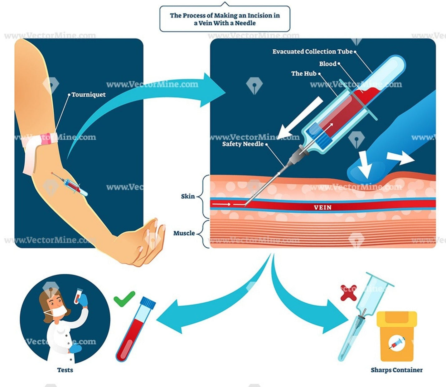 Phlebotomy Courses